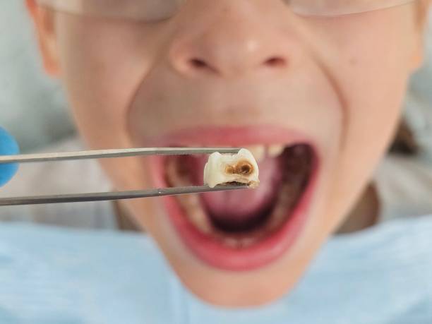 Best Urgent Dental Care for Toothache in Iceville, AL